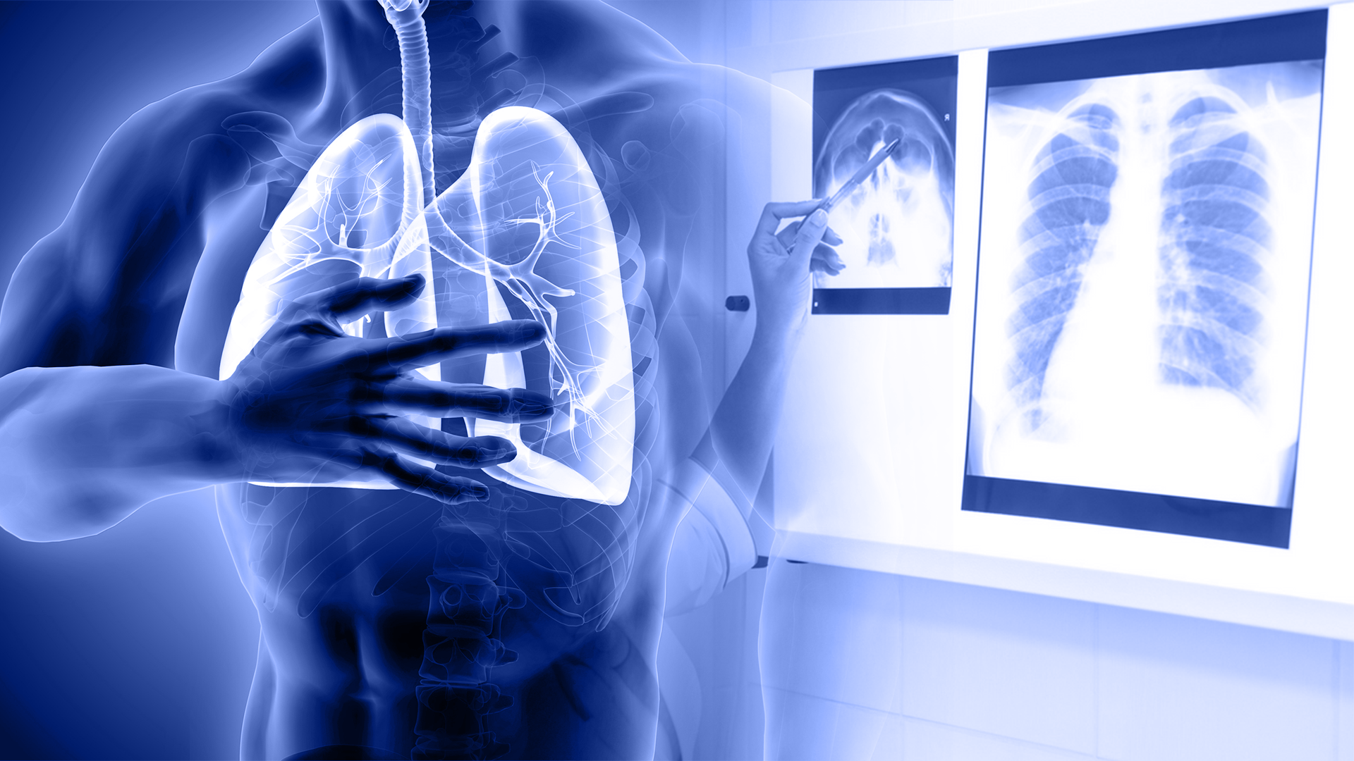 Akciğer ve Göğüs Hastalıklarında Radyolojik Değerlendirmeler